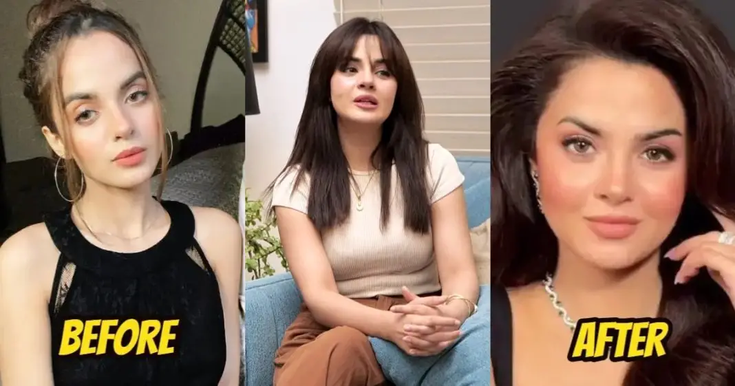 Komal Meer Face Change