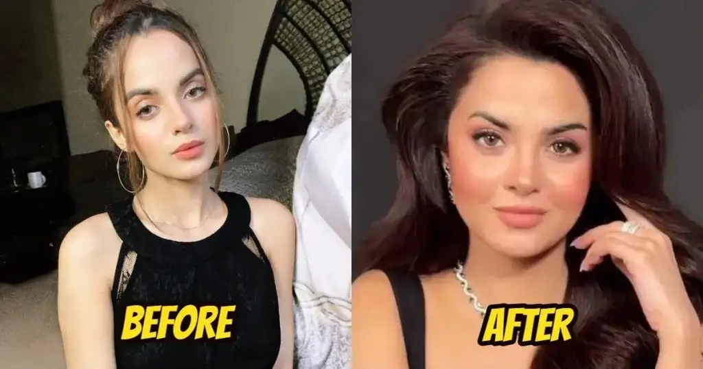 Komal Meer Face Change